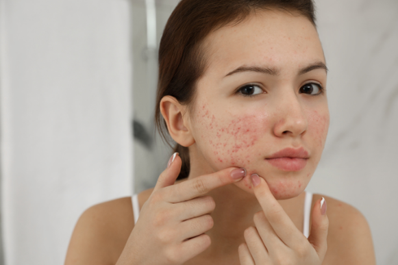 Skin problems